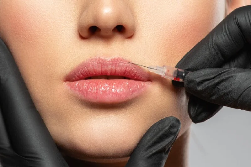 Witness An Ultimate Lip Transformation At Premier Beauty