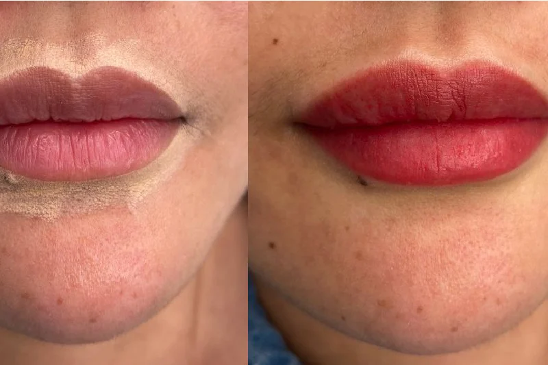 Lip Blushing